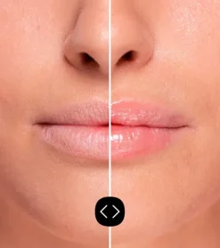 Brillo de labios voluminizador Hyaluronic Lip Volumiser><noscript><img width=